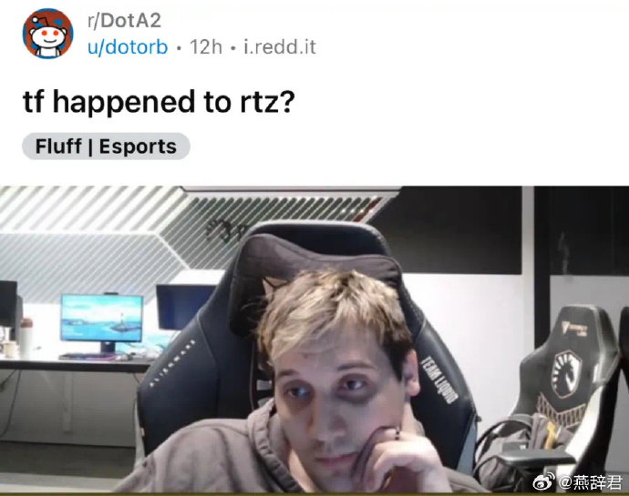 What Is Rtz RTZ辟谣:我面容憔悴是因为得了颈椎病_5EPlay - 5EPlay赛凡网
